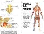 Sciatica pain pic pranic&nbsp;healing